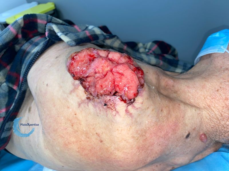 Fichier:Nodule5.jpg