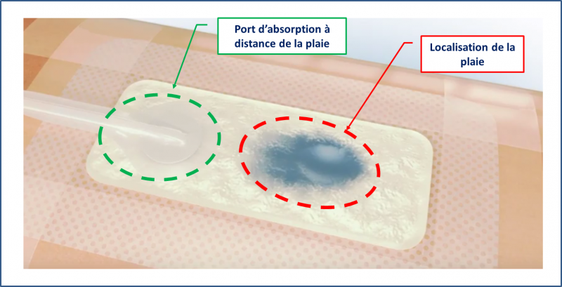 Fichier:Avelle9.png