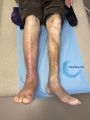 Dermiteocre74.jpg