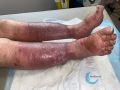 Grosses jambes suintantes55.jpg