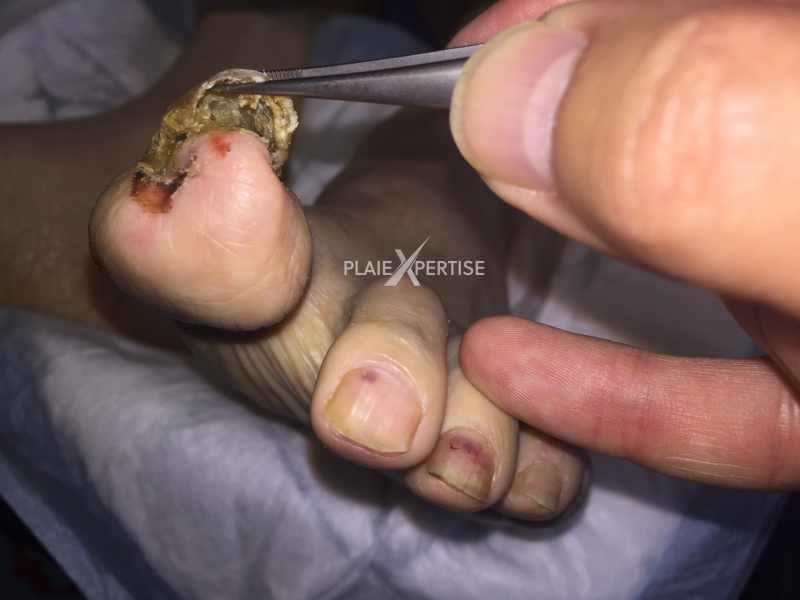 Fichier:Ongles12.png