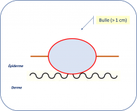 Bulle.png
