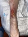 Cou de pied88.jpg