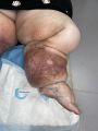 Lipoed15.jpg