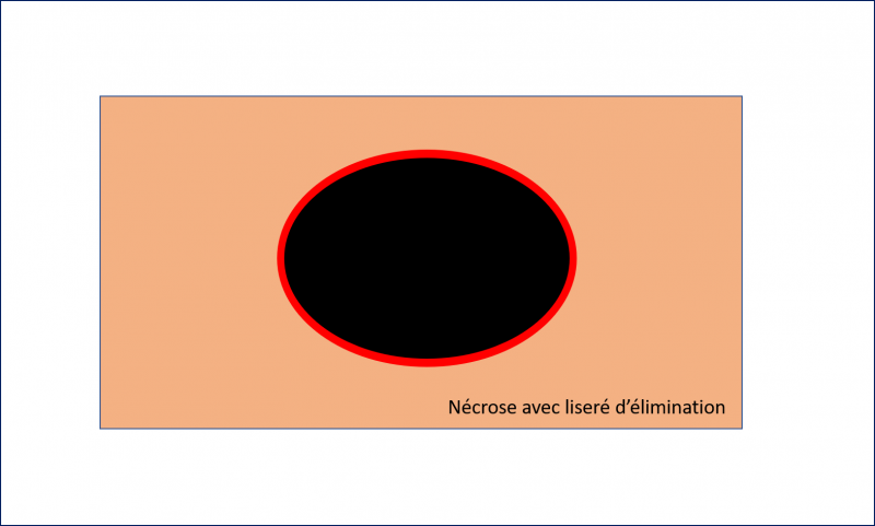 Fichier:LE5.png
