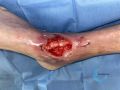Cou de pied79.jpg