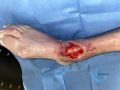 Cou de pied78.jpg