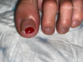 Ongles37.png