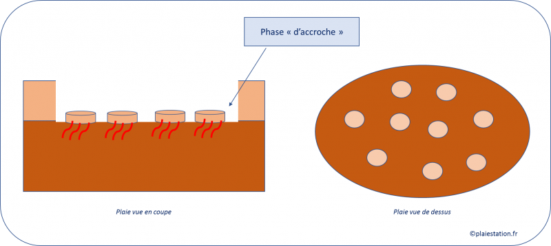 Fichier:5. Phase d'ancrage.png
