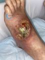 Cou de pied100.jpg
