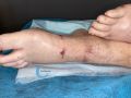 Compression EI21.jpg