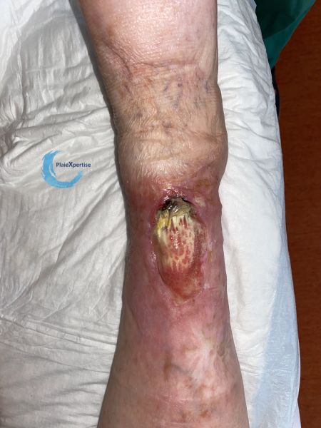 Fichier:Cou de pied87.jpg
