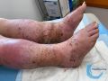 Grosses jambes suintantes50.jpg