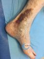 Dermiteocre67.jpg