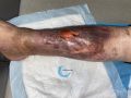 Dermiteocre92.jpg