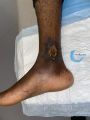 Drépanocytose18.jpg