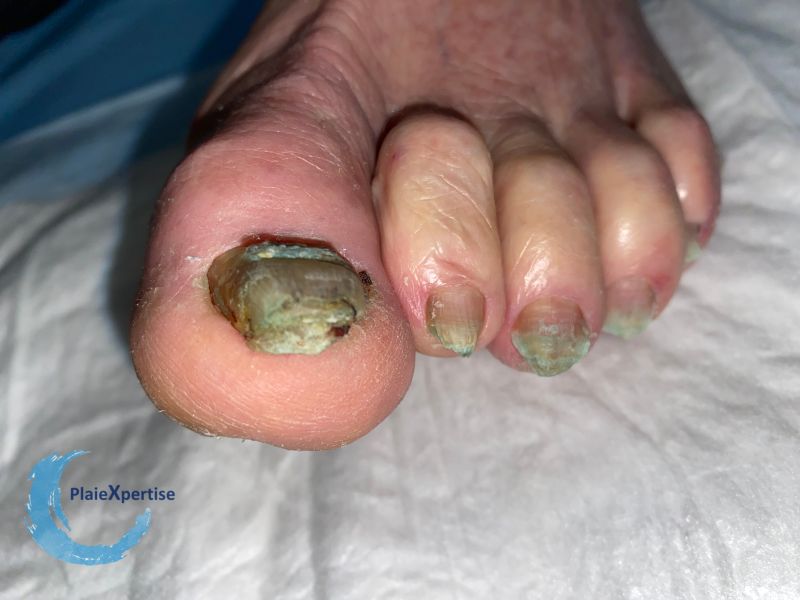 Fichier:Ongles70.jpg