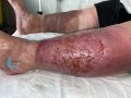Grosses jambes suintantes38.jpg