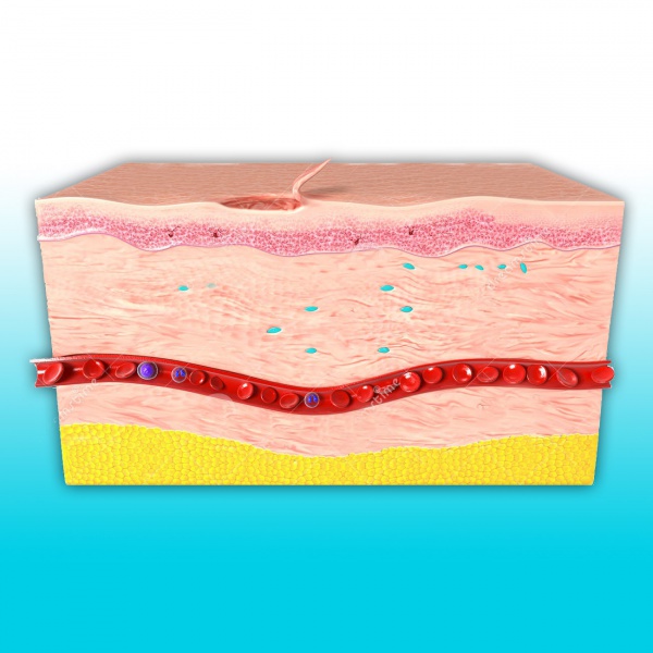 Fichier:Anatomie-peau-plaie.jpg