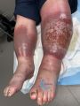 Grosses jambes suintantes37.jpg