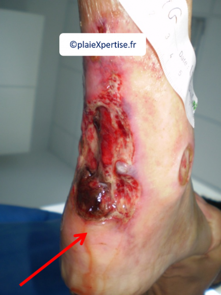 Fichier:Oss2.png