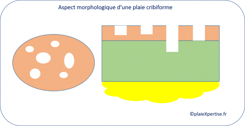 Fichier:Cribi6.png