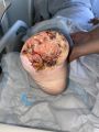 Amputation71.jpg