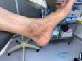 Dermiteocre78.jpg