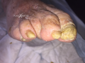 Ongles13.png