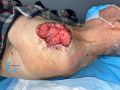 Nodule3.jpg