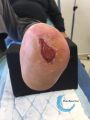 Amputation19.jpg