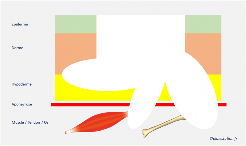 Fichier:Cav6.png