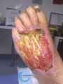 Cou de pied62.jpg