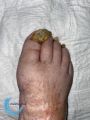 Ongles68.jpg