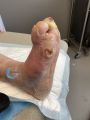Charcot55.jpg