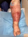 Grosses jambes suintantes44.jpg