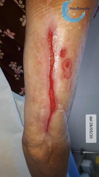 Fichier:Casw11.jpg