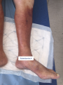 Dermiteocre20.png