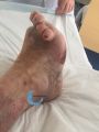 Pied déformé13.jpg
