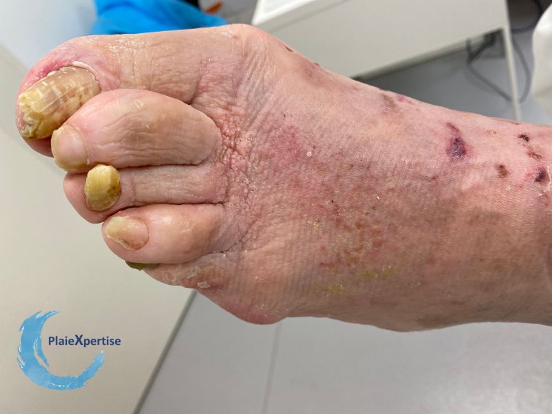 Fichier:Ongles74.jpg