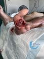 Amputation59.jpg