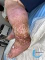 Grosses jambes suintantes51.jpg